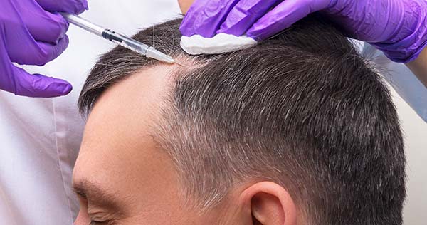 HairRestoration
